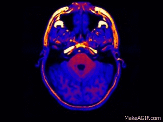 3D MRI of human brain